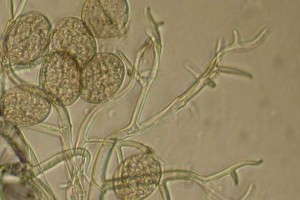Downy Mildew Sporulation
