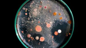 Video of the Week: How to Choose a Microscope for Your Growing Operation