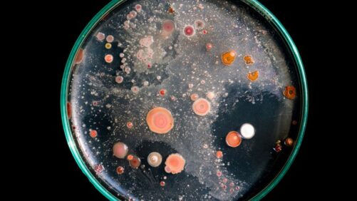 Video of the Week: How to Choose a Microscope for Your Growing Operation